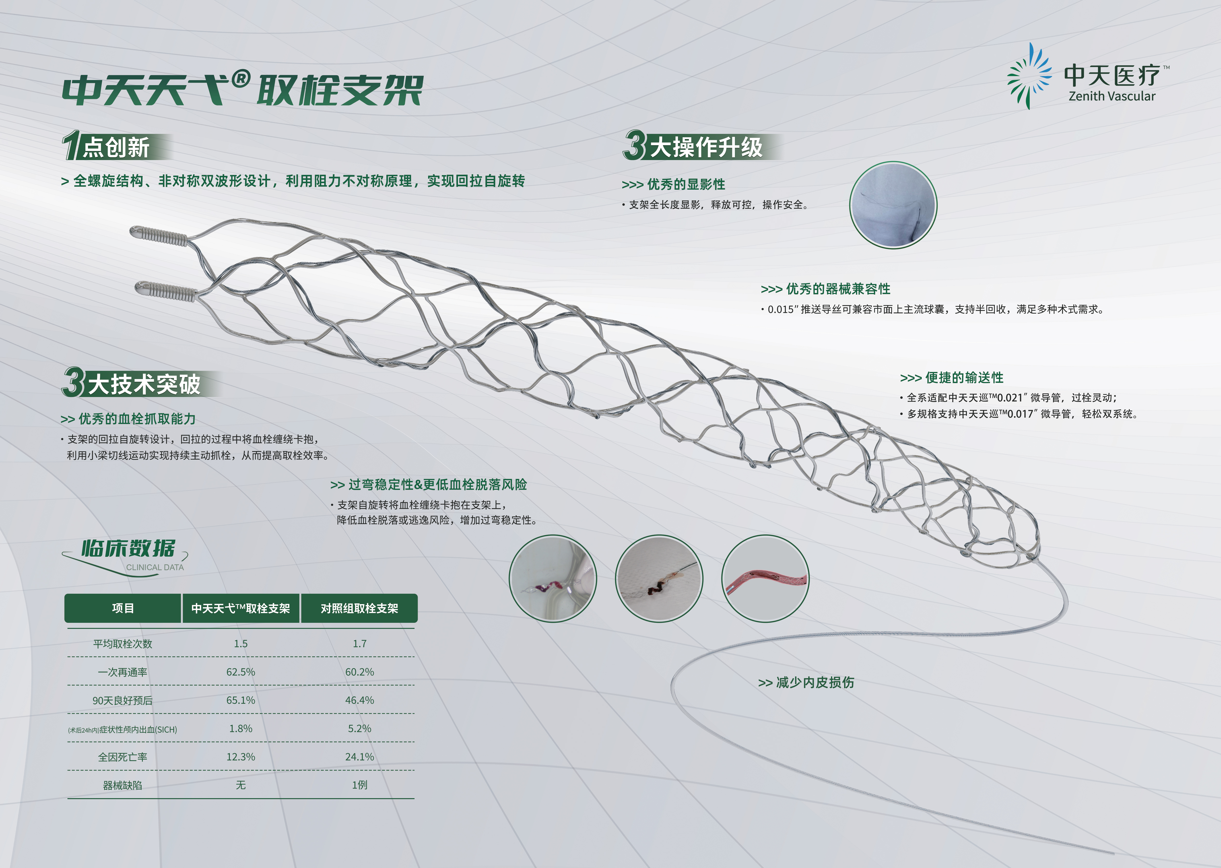 中天天弋<sup>®</sup>颅内取栓支架