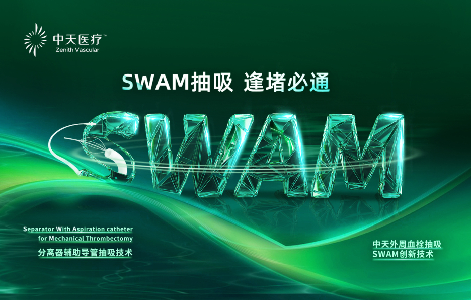 SWAM抽吸 逢堵必通 I SWAM抽吸技术联合髂静脉支架治疗DVT的病例分享